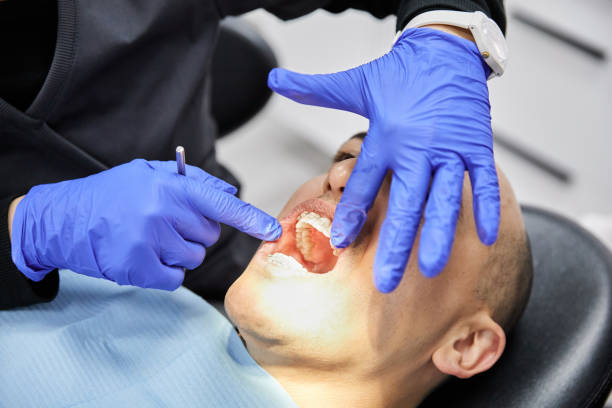 Best Knocked-Out Tooth (Avulsed Tooth) Treatment in Lovettsville, VA